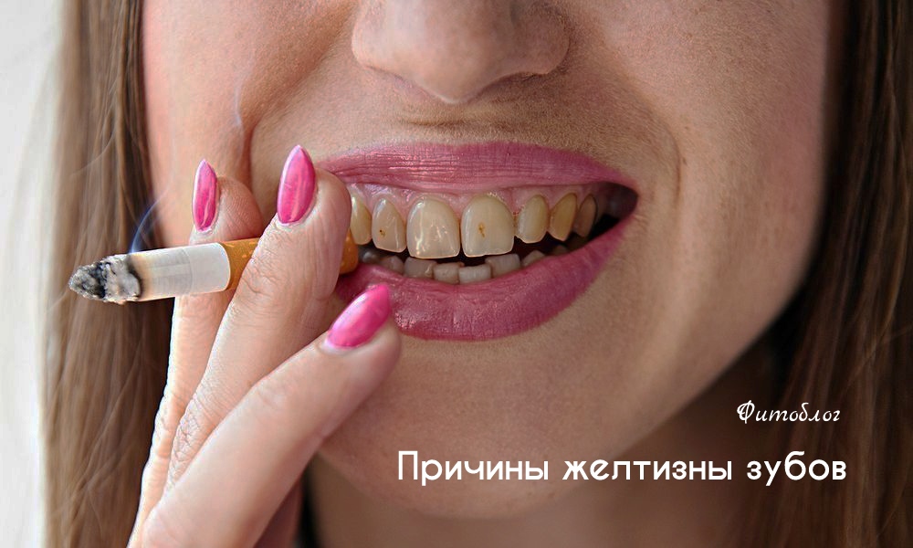 Как отбелить зубы в домашних условиях без вреда для эмали